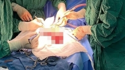 Cắt khối u máu trong gan cứu bé 14 ngày tuổi