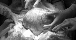 Uống thực phẩm chức năng chợ trời, người đàn ông "mang bầu"