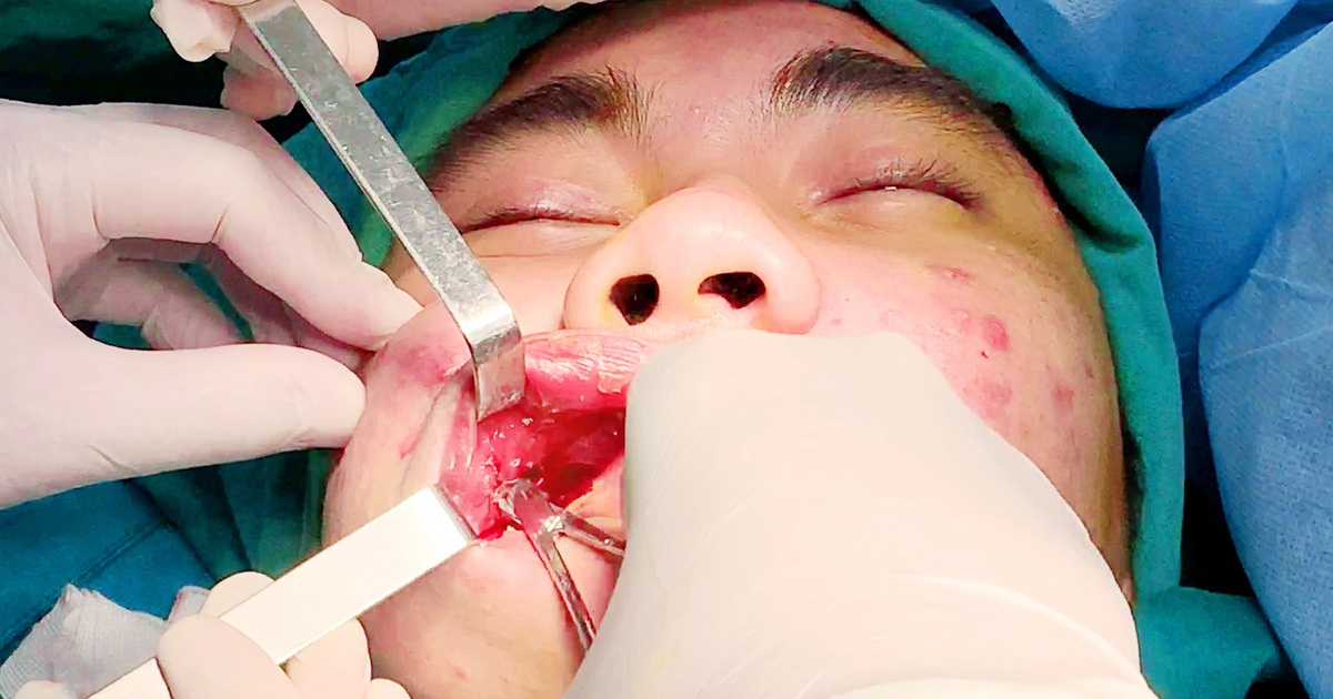 Biến chứng tập thể, tử vong vì tiêm silicon lỏng "hàng Thái xách tay"