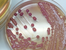 Những phiền toái từ hội chứng tự sinh rượu trong cơ thể