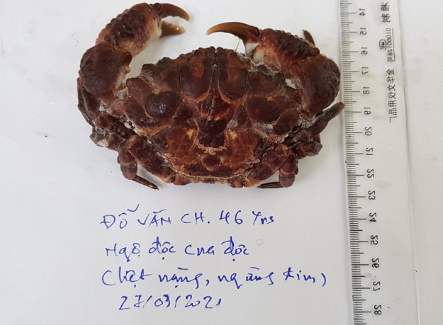 Ăn cua mặt quỷ, người đàn ông bị ngừng tim