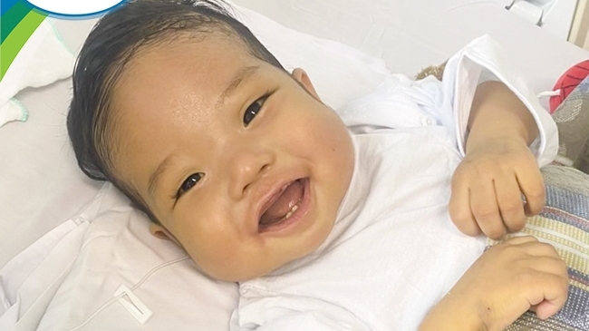 Bé trai 9 tháng tuổi bị xơ gan mật được ghép gan thành công