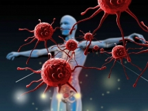 10 căn bệnh liên quan đến thói quen lười vận động