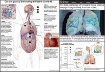 Những mặt trận virus nCoV tấn công cơ thể