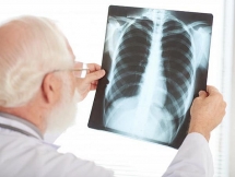 10 biến chứng nguy hiểm của bệnh Covid-19