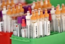 Những người từng mắc SARS cách đây 17 năm có nhiễm COVID-19?