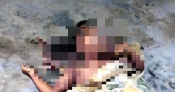 Điện thoại đang sạc phát nổ, nam thanh niên tử vong