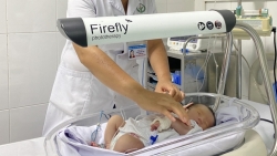 Phẫu thuật nội soi chữa thoát vị hoành bẩm sinh cho bệnh nhi 1 ngày tuổi