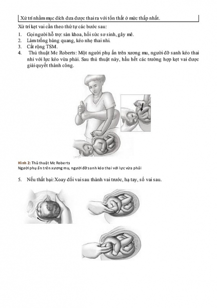 sinh kho do ket vai tai biet san khoa dang so va bi tham nhat