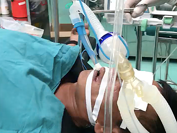 Suýt chết vì hút dầu diesel bằng miệng cuu song mot benh nhan suyt chet vi hut dau diesel bang mieng