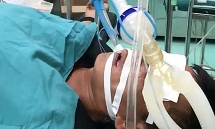 Suýt chết vì hút dầu diesel bằng miệng