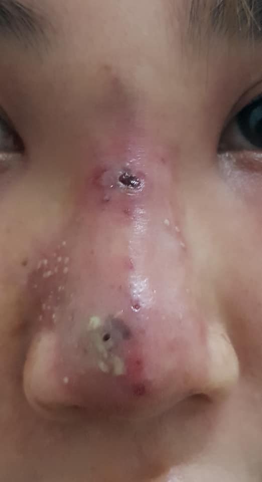 bi hoai tu vi bom chat lam day tai cac co so khong phep