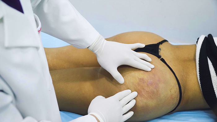 bi hoai tu vi bom chat lam day tai cac co so khong phep