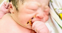 Bé trai "đội" vòng tránh thai chào đời khoẻ mạnh