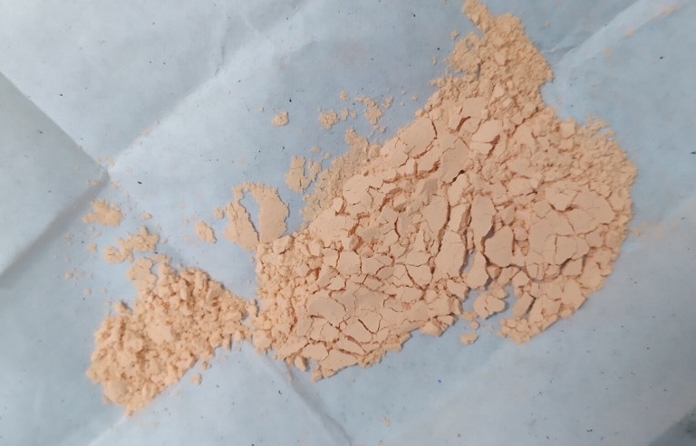 Bé 3 tháng tuổi ngộ độc chì do đánh tưa lưỡi bằng thuốc cam