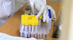 Hà Nội: Hơn 200.000 người đã được lấy mẫu trong đợt xét nghiệm diện rộng