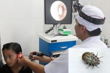 Ve chó chui vào tai, cắn bé gái 10 tuổi đến hoảng loạn