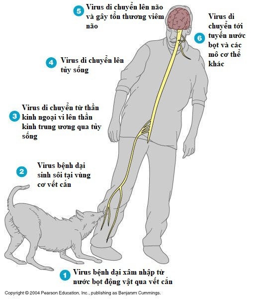 Bác sĩ xót xa trước phút cuối của bệnh nhân bị chó cắn chữa thuốc Nam