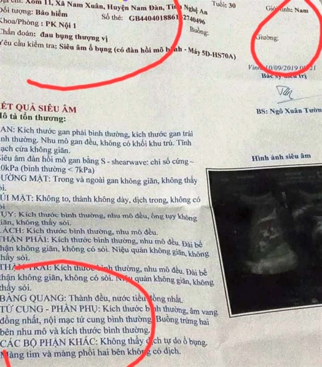 Người đàn ông ở Nghệ An sốc khi kết quả siêu âm có tử cung, buồng trứng