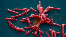 Vi khuẩn gây bệnh Whitmore được liệt vào nhóm nguy cơ sử dụng như "khủng bố sinh học"