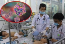 Đa số trường hợp tử vong do sốt xuất huyết đều nhập viện muộn