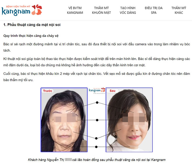 Sở Y tế chỉ đạo làm rõ vụ phụ nữ tử vong sau khi làm đẹp ở BV Kangnam