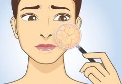 Dấu hiệu cảnh báo cơ thể đang thiếu canxi