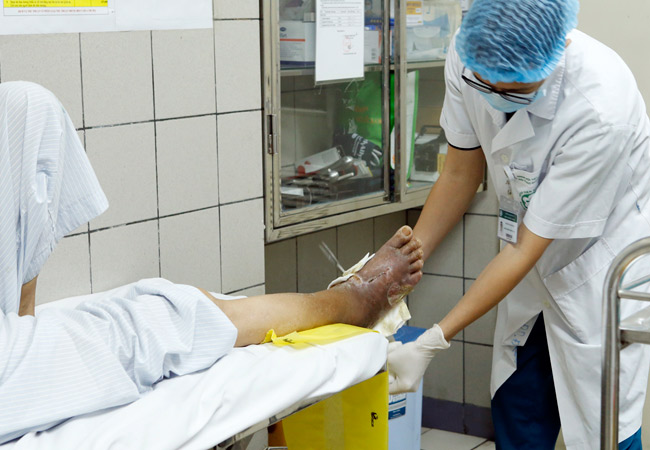 Nhiều người Việt đang sống với căn bệnh gây biến chứng mù mắt, cắt cụt chi mà không biết