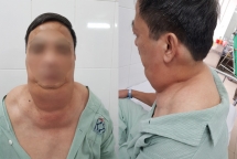 Uống rượu 40 năm, người đàn ông Hà Nội thành ‘dị nhân’