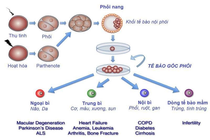 Ghép tế bào gốc miễn phí cho người bị chấn thương sọ não