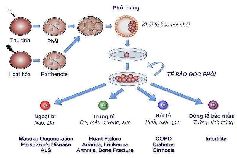 Ghép tế bào gốc miễn phí cho người bị chấn thương sọ não