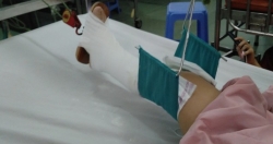 Vụ bé 4 tuổi gãy chân tại trường: Cô giáo quỳ khóc xin lỗi