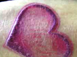 Nguy cơ mắc hàng loạt bệnh sau xăm hình