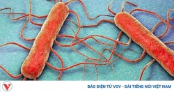 Những nơi vi khuẩn trú ngụ nhiều nhất trong nhà bạn