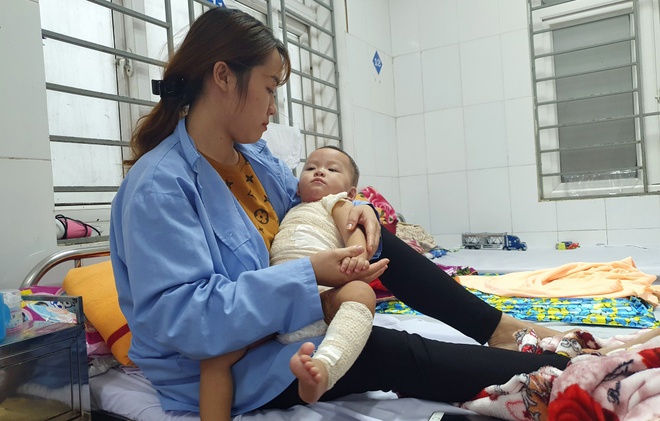 Con bị hoại tử sau khi mẹ đưa đến thầy lang chữa bỏng