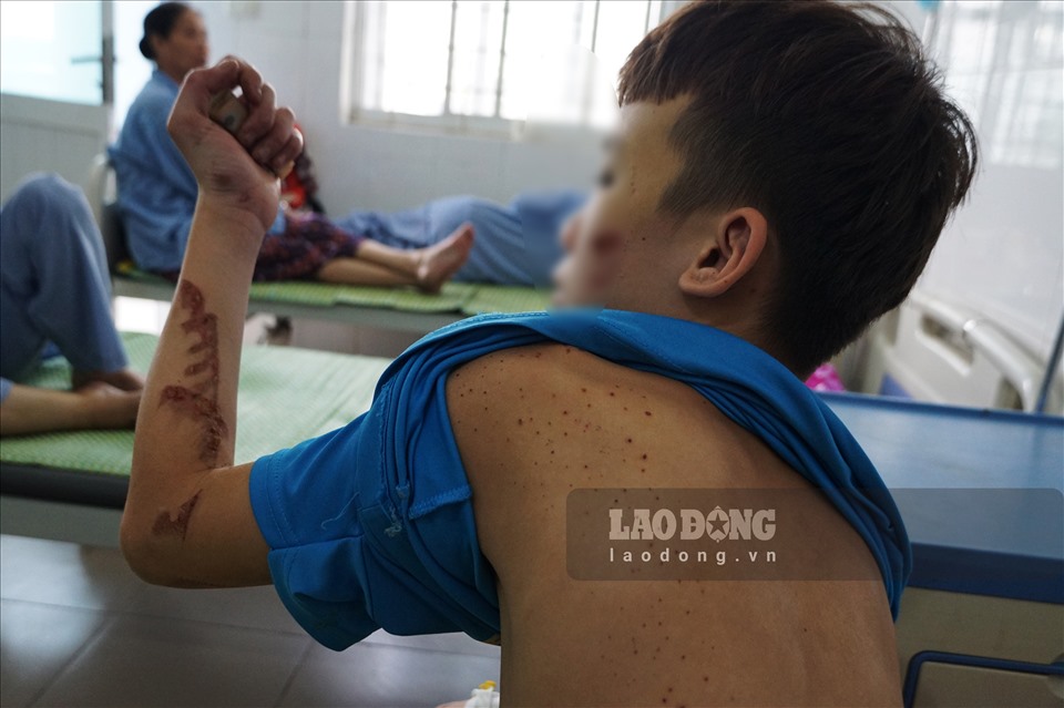 4 giờ tháo chạy khỏi "địa ngục trần gian" của bé trai làm ở quán bánh xèo