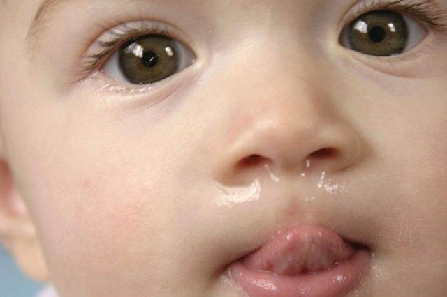 Rét đậm, rét hại: Đoán bệnh qua màu nước mũi của trẻ - 3