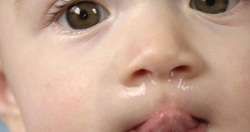 Rét đậm, rét hại: Đoán bệnh qua màu nước mũi của trẻ