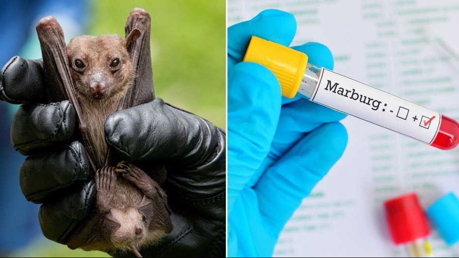 TP HCM yêu cầu tăng cường giám sát phòng, chống dịch bệnh Marburg