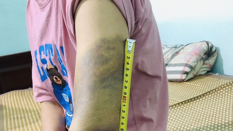 Bắc Giang: Đánh vợ, người đàn ông bị phạt 15 triệu đồng